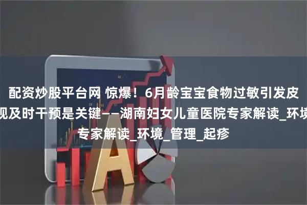 配资炒股平台网 惊爆！6月龄宝宝食物过敏引发皮疹，早期发现及时干预是关键——湖南妇女儿童医院专家解读_环境_管理_起疹